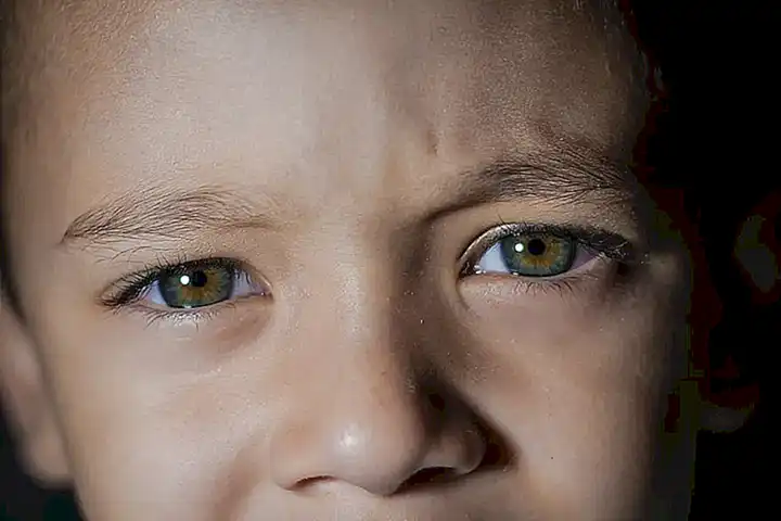 Consideraciones especiales para el cuidado de los ojos de los niños
