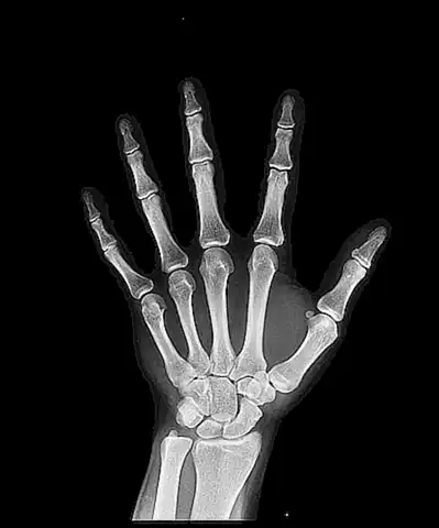 Diagnóstico mediante radiografía