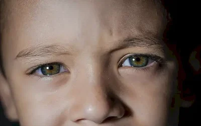 tratamiento-de-las-enfermedades-de-los-ojos-en-ninos_h2_471.webp
