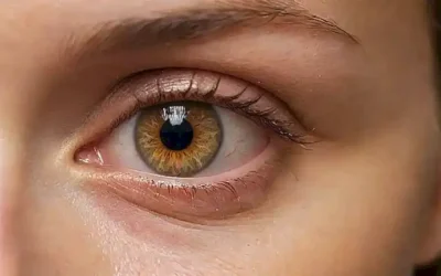 Lasretinas doradas
