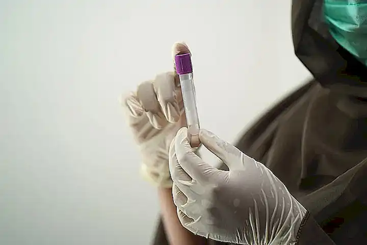 Muestras de sangre y tejido